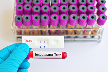 Toxoplasma Test